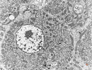 M,19y. | normal hepatocyte